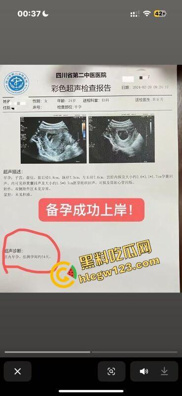 老套路玩不腻，江西老哥约小仙女无套爽完2周内直接中标！说怀孕就怀孕，喜当爹都反应不过来！-9